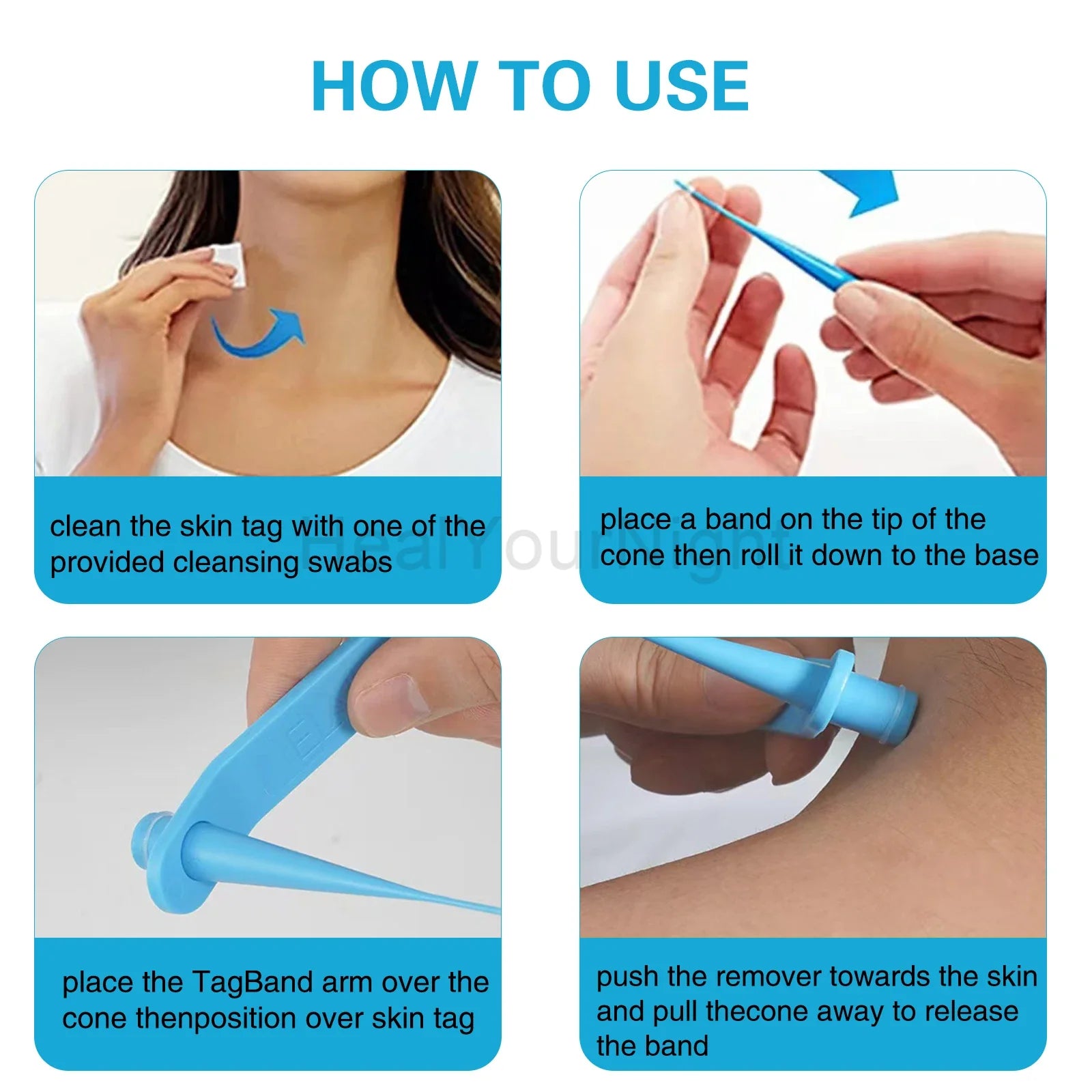 3-IN-1 Painless Skin Tag Removal Kit | Skin Label, Mole, Acne & Wart Removal Pen Set with Cleansing Swabs
