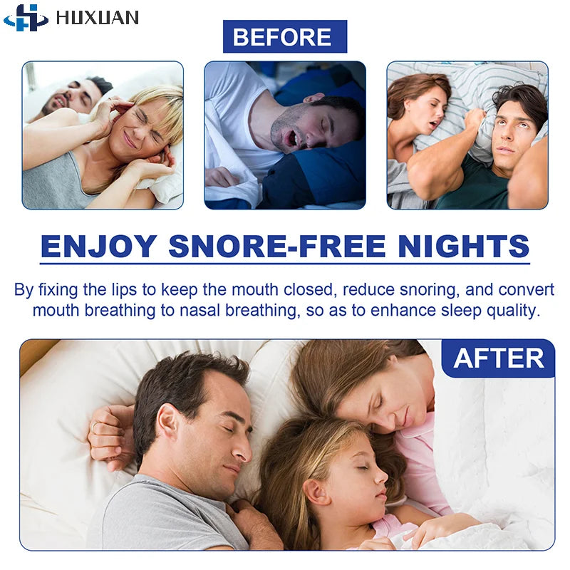 Stop Snoring Patch | Gentle Mouth Tape for Better Sleep and Nose Breathing