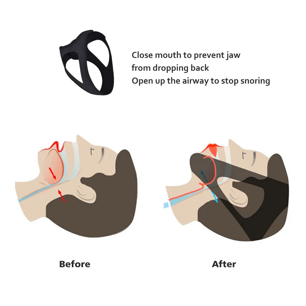 Anti Snore Chin Strap for CPAP Users | Mouth Tape Alternative for Snoring Relief