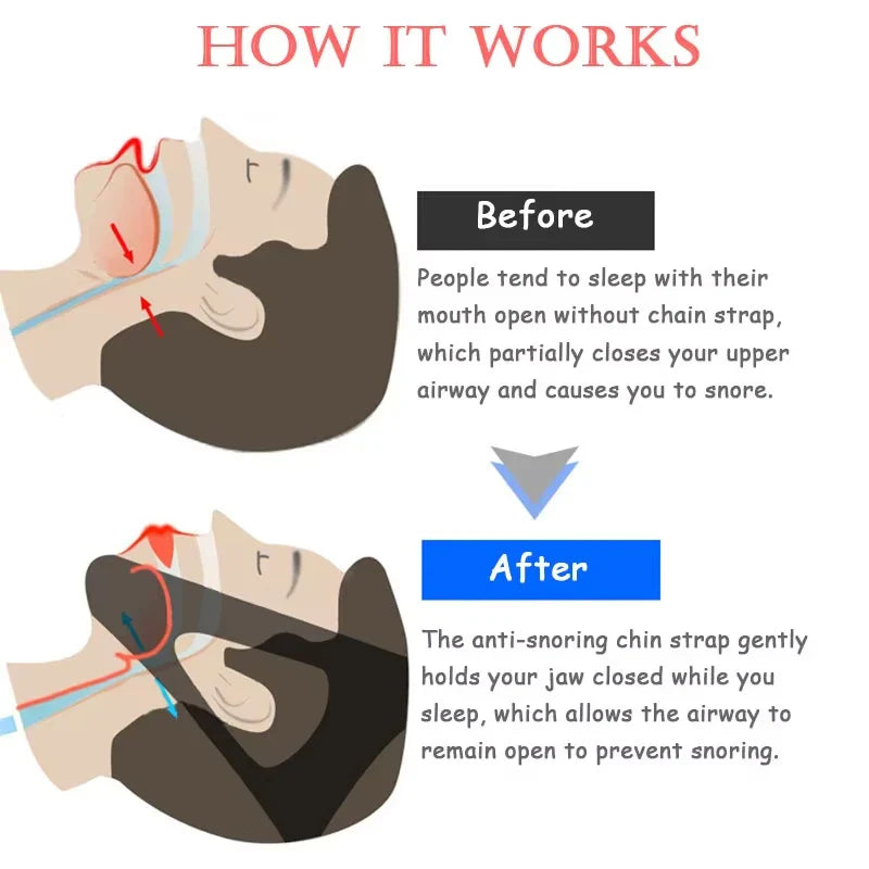 Anti Snore Chin Strap | Sleep Aid for Snoring Relief