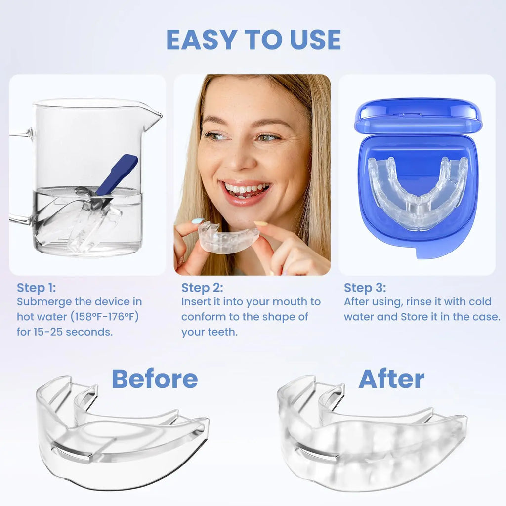 Anti Snoring Mouth Guard | Bruxism Night Guard for Teeth Grinding and Sleep Apnea